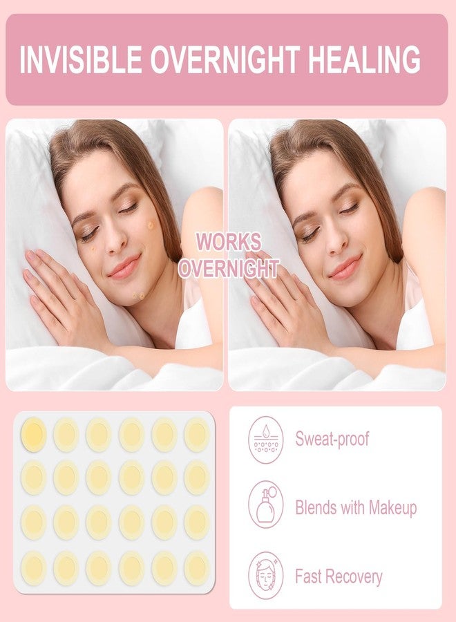 Vathery Pimple Patches Set with Microdart Pimples Patche and Hydrocolloid Patch – 3-Step Acne Kit for Fast Blemish Removal, Blackhead Extractor Tools, Zit Patches for Face - Image 5